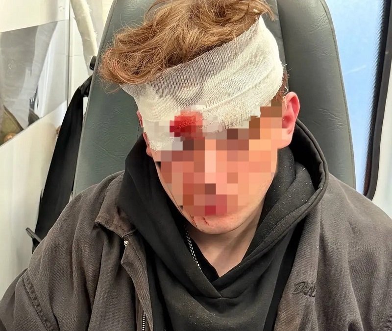 Петербуржец пытался разнять драку, а драчуны его избили и выстрелили ему в голову - Выстрелом в голову закончился конфликт с мужчиной возле сетевого бара на Владимирском проспекте в Са